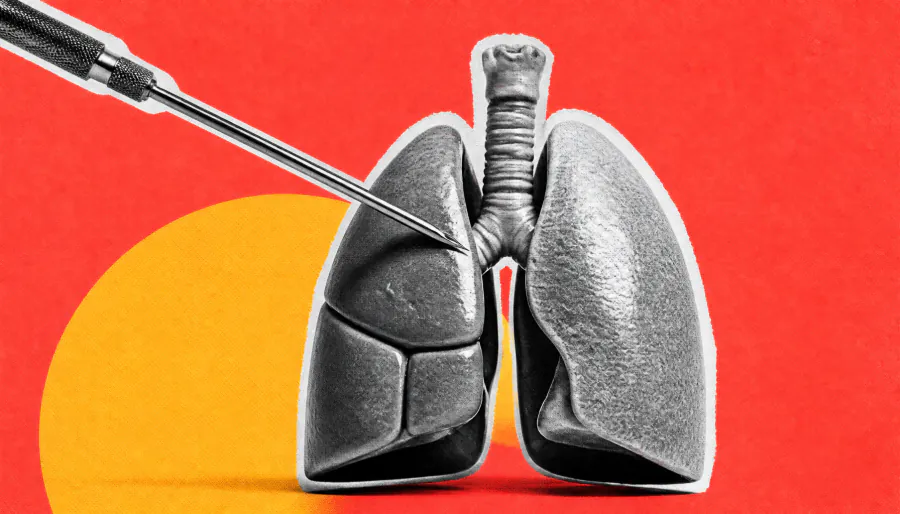 Organ transplant recipients face elevated cancer risk — and lung transplant patients have it worst