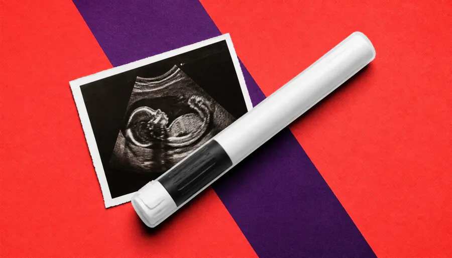 Migraine drugs in early pregnancy tied to higher miscarriage risk