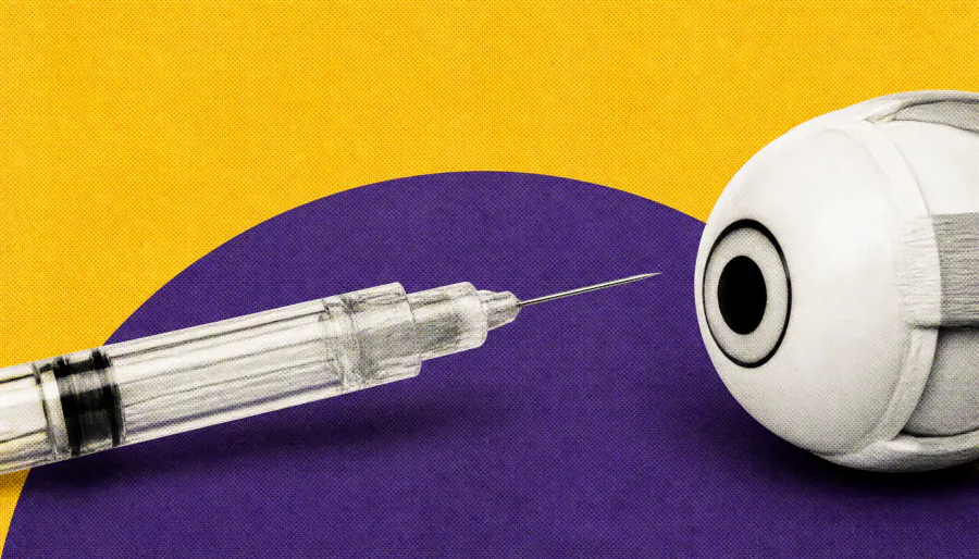 Fluocinolone implant shows durable vision gains in posterior uveitis trial