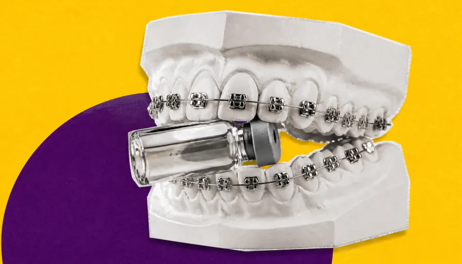 Piezo channels: The molecular key to smarter orthodontic treatment