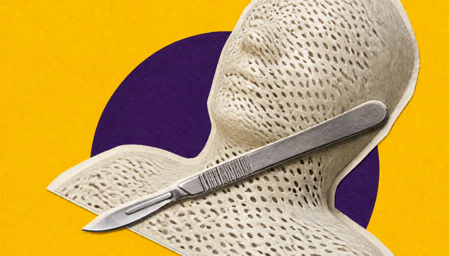 Surgery vs. radiation for prostate cancer: The trade-offs are real and significant
