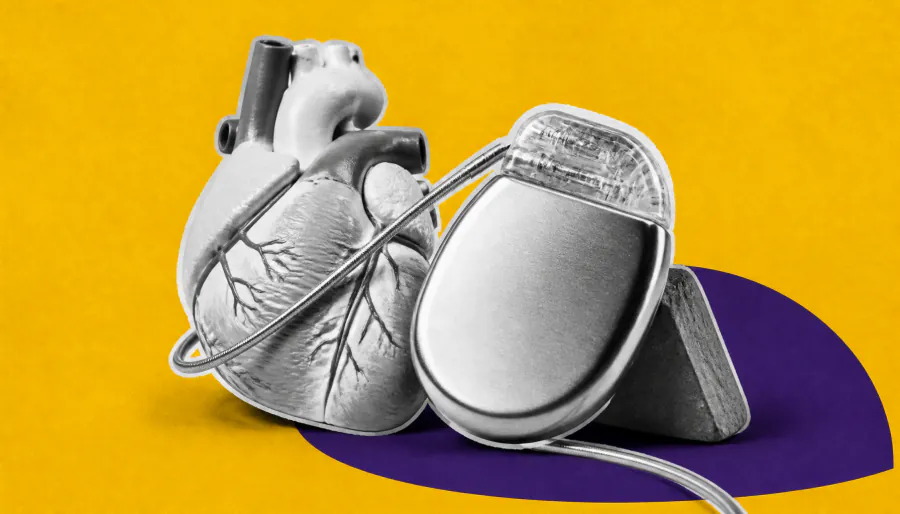 Baroreflex activation therapy shows promise beyond its FDA-approved label in heart failure patients