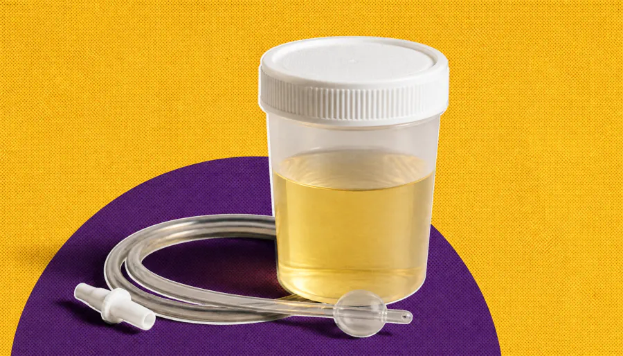 Erectile dysfunction is surprisingly common in men with bowel disorders — and it's not what you'd expect