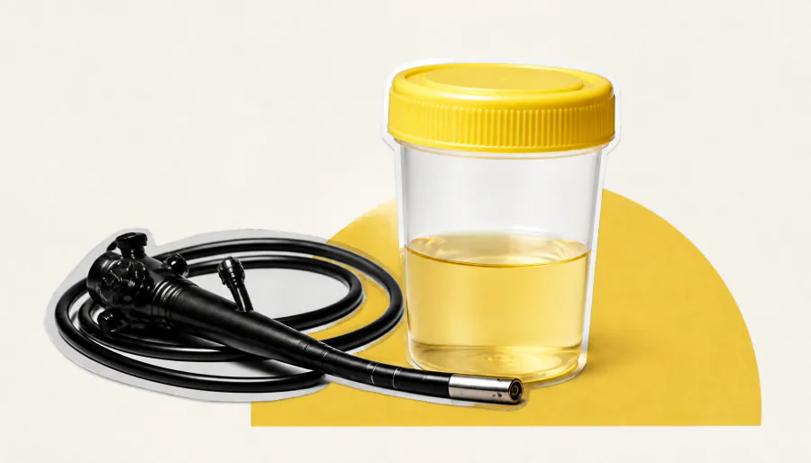 A simple urine test could transform bladder cancer detection and treatment