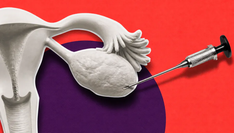 Your ovaries don't retire after menopause — and that matters for cancer risk