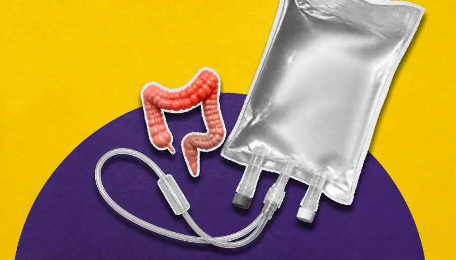 FDA greenlights immunotherapy combo for stage III colon cancer — cutting recurrence risk in half