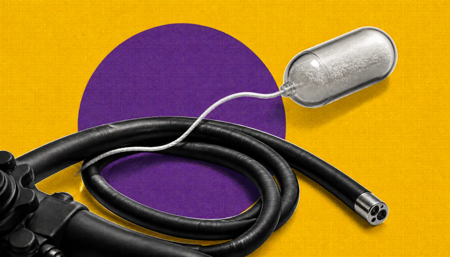 A swallowable sponge test could transform Barrett's esophagus screening