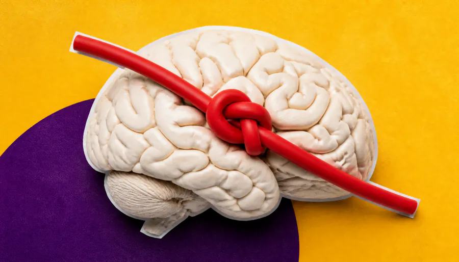 Strokes are surging in younger adults — and doctors don't fully know why
