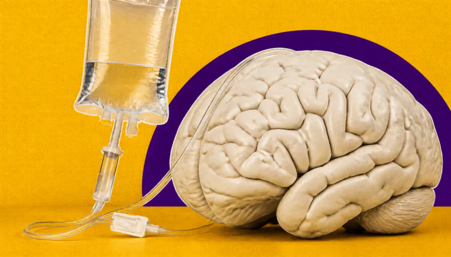 Clearing amyloid plaques may shield the brain from Alzheimer's damage long-term