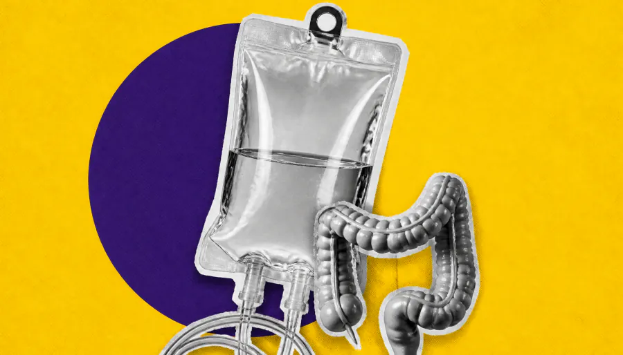 IBD patients on cancer immunotherapy face higher colitis risk — but most can keep treatment going