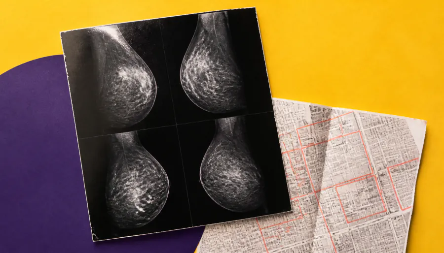 Historic redlining still drives breast cancer screening gaps today