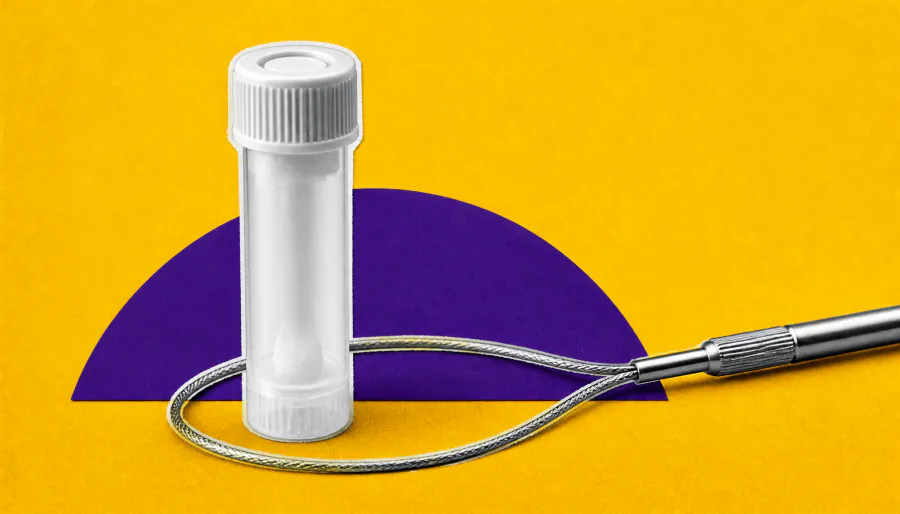 One-size-fits-all colorectal cancer screening may shortchange women