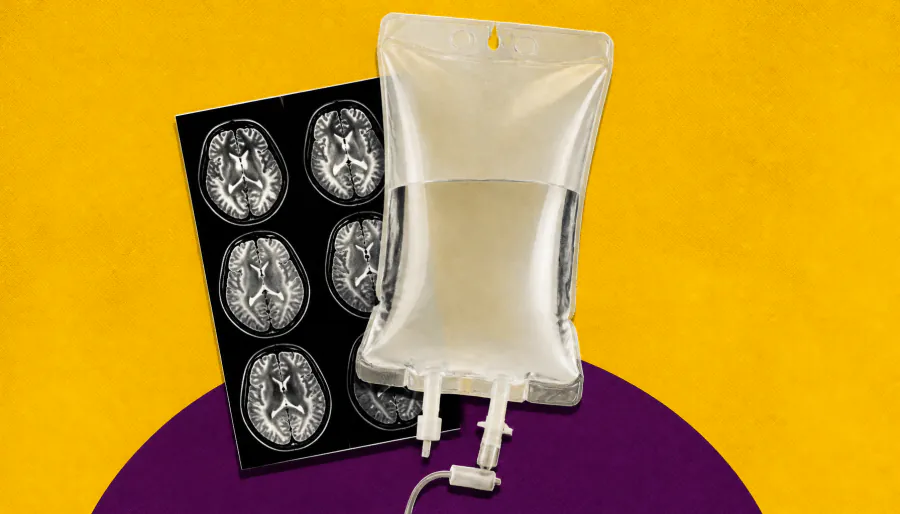 Ocrelizumab outperforms fingolimod on MRI measures in kids with MS