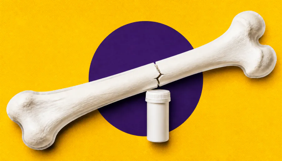 Epilepsy drugs are quietly weakening patients' bones — and most aren't getting the fix they need