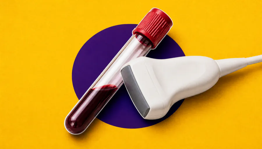 Thyroid cancer remission can't rely on one number alone, study warns