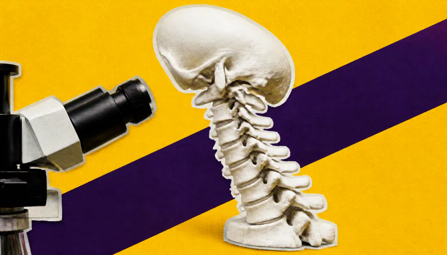 Ophthalmologists are paying the price for bad posture — here's how to fix it