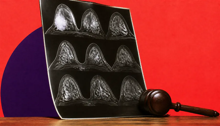 FDA clears first AI-powered MRI tool to predict breast cancer recurrence risk