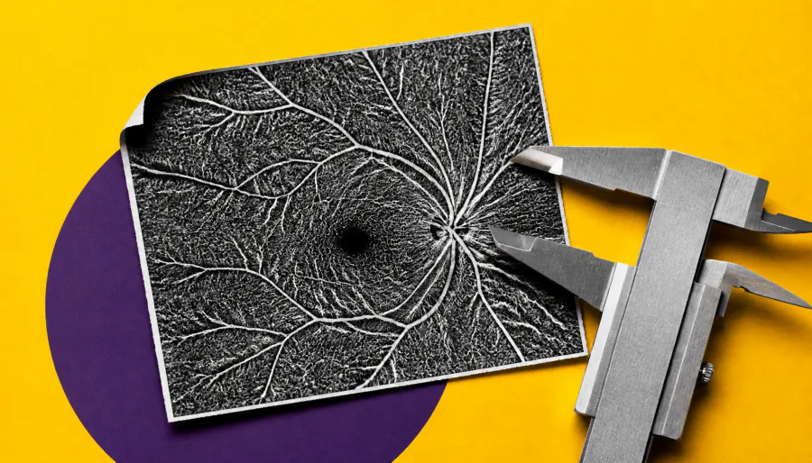 Eye scans may hold the key to tracking diabetic retinopathy over time