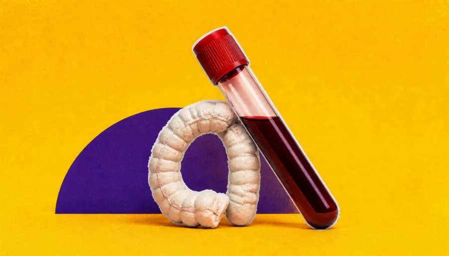 Upgraded blood test for colorectal cancer catches more precancerous lesions