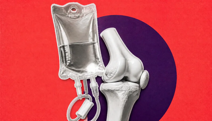 Immune memory may explain why cancer immunotherapy triggers recurring, worsening arthritis