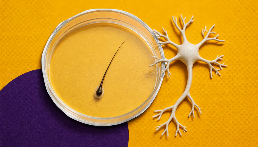 Novel cell therapy aims to replace lost neurons in Alzheimer's disease