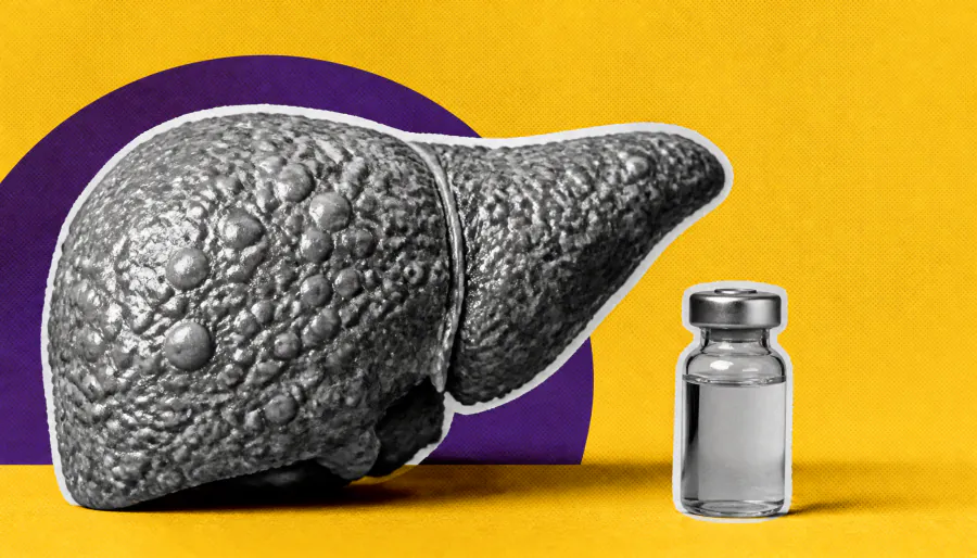 New clinical guidelines set the standard for preventive care in cirrhosis