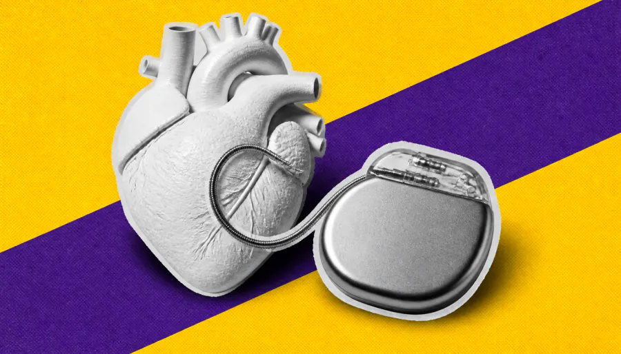 Real-world data confirm lasting benefits of cardiac contractility modulation therapy for heart failure