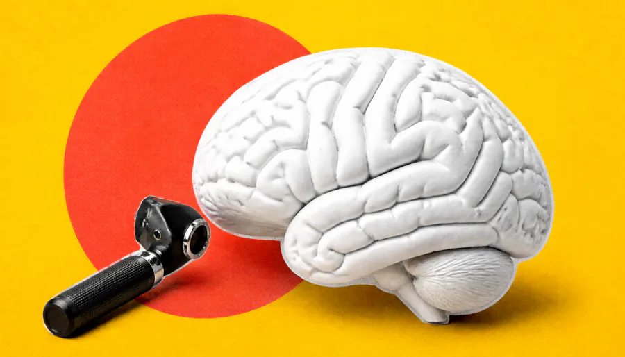 Your eyes may hold the key to predicting stroke risk