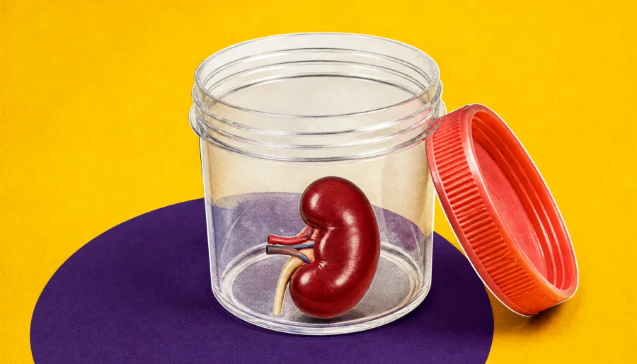 DaVita's community kidney screenings are catching silent disease before it's too late