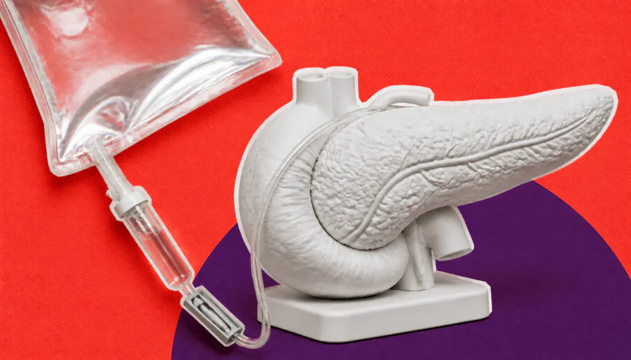 FDA fast-tracks MC001, a novel ADC targeting pancreatic cancer