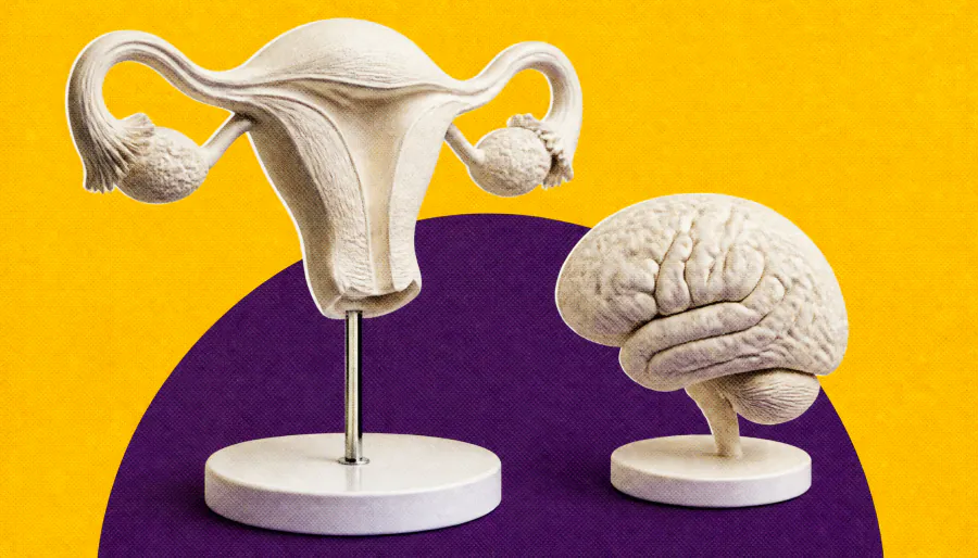 Migraine and endometriosis are far more connected than doctors realize