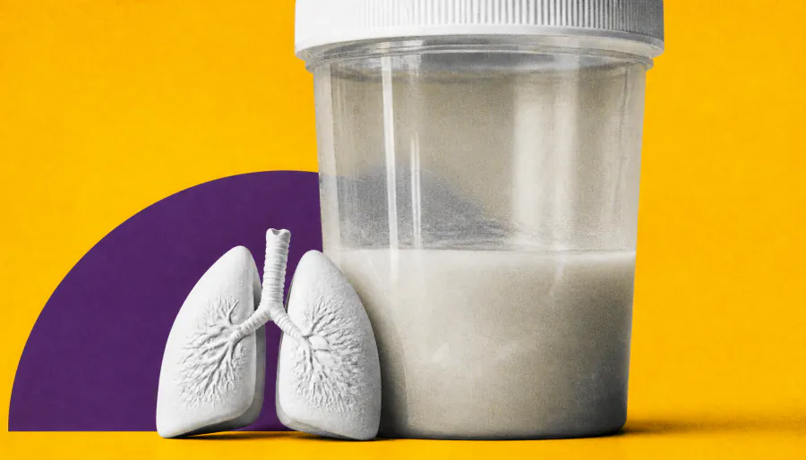 Sputum color is a surprisingly reliable window into bronchiectasis severity