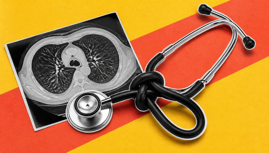 Lung cancer screening is falling far behind — and most eligible Americans don't even know it exists