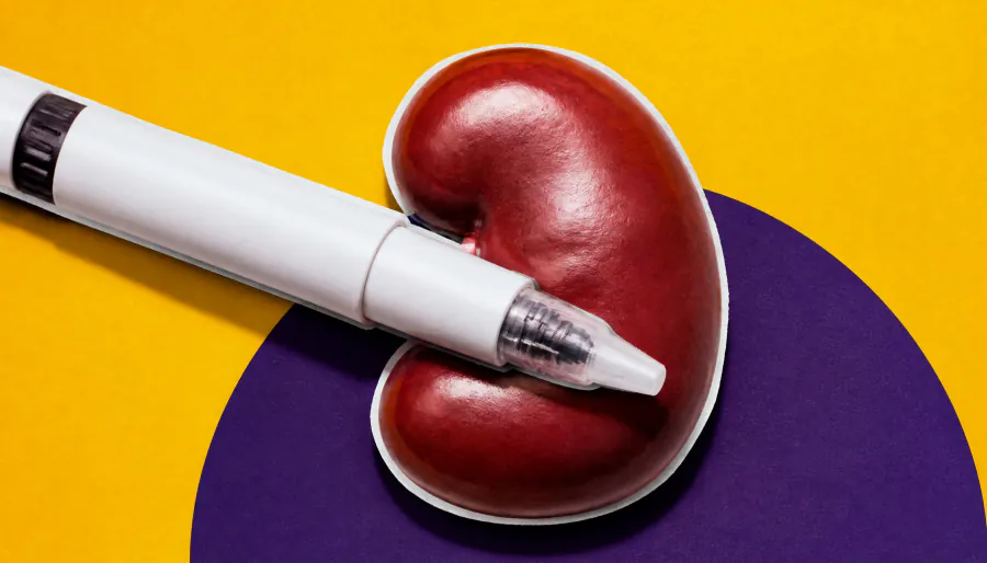 Atacicept-vymj delivers strong 2-year results for IgA nephropathy, paving the way for full FDA approval