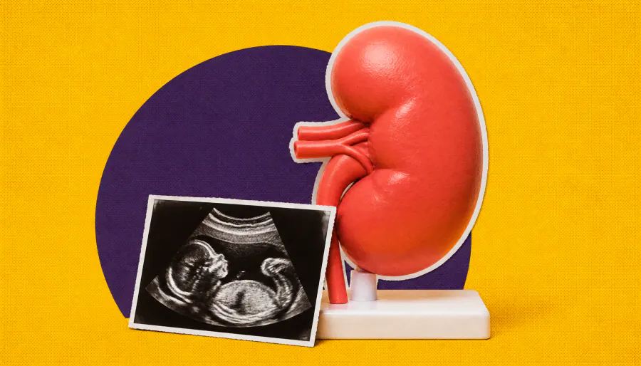 Kidney donors can have healthy pregnancies — but some risks remain