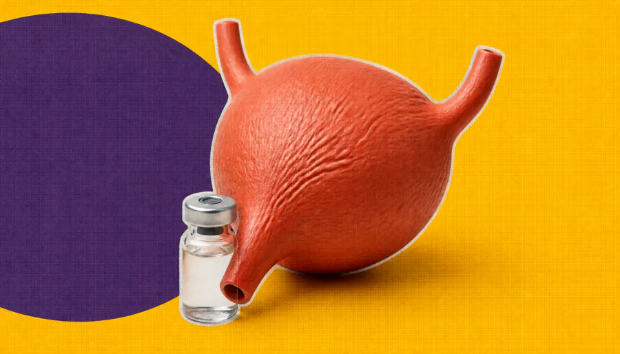 Durvalumab + BCG combo cuts bladder cancer recurrence risk by 44% in key subgroup