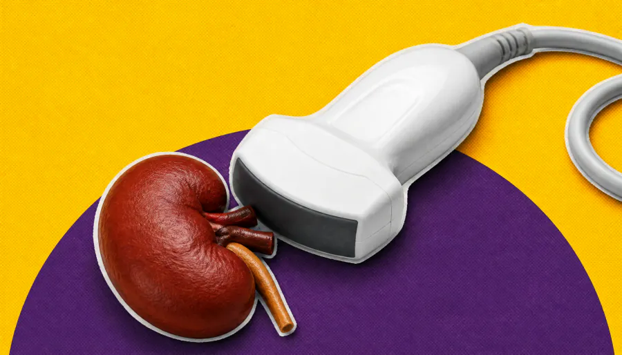 Pregnancy after kidney transplant: What 30+ years of data tells us