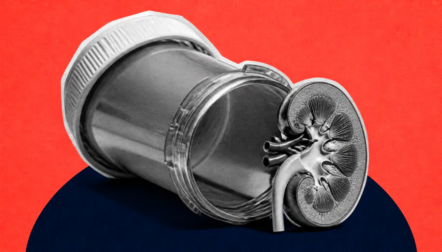 Renal failure deaths linked to substance use disorder surge 14-fold in 25 years