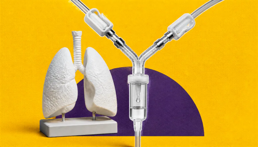 Tarlatamab combo nearly doubles survival in small cell lung cancer, poised to become new standard of care