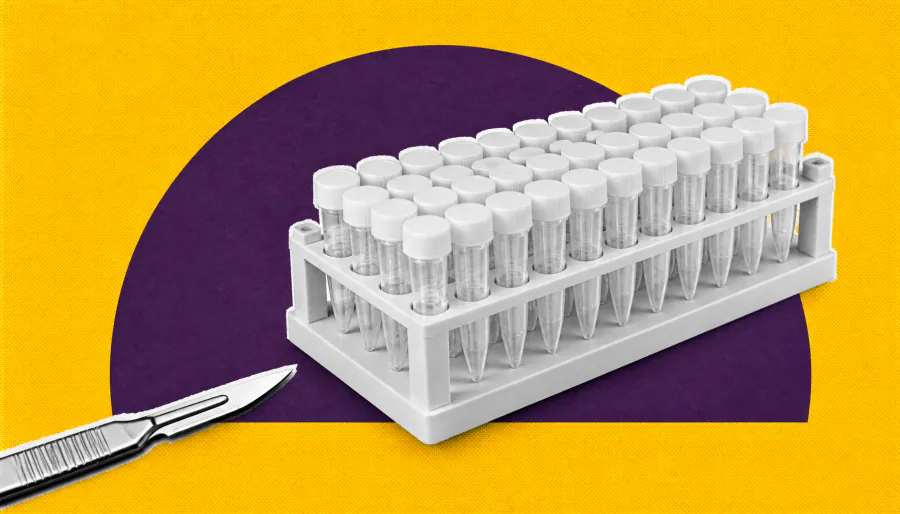 Diagnosing TK2D: Why whole exome sequencing may beat starting with a panel
