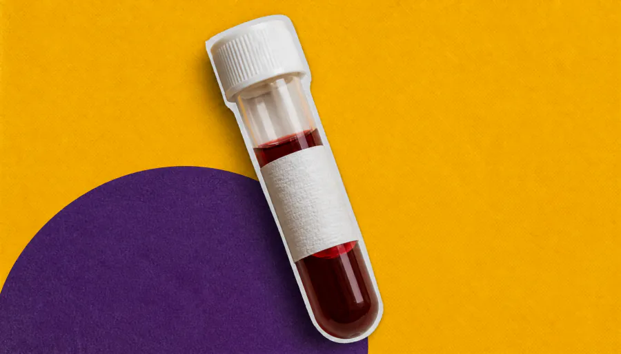 Alzheimer's blood biomarker may miss cognitive risk in minority populations