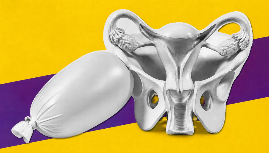 Bloating and gas are a persistent problem for women across all stages of menopause