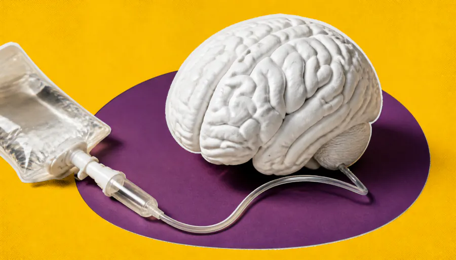 Roche's brain-shuttling Alzheimer's drug heads into phase 3 — and it's clearing amyloid fast
