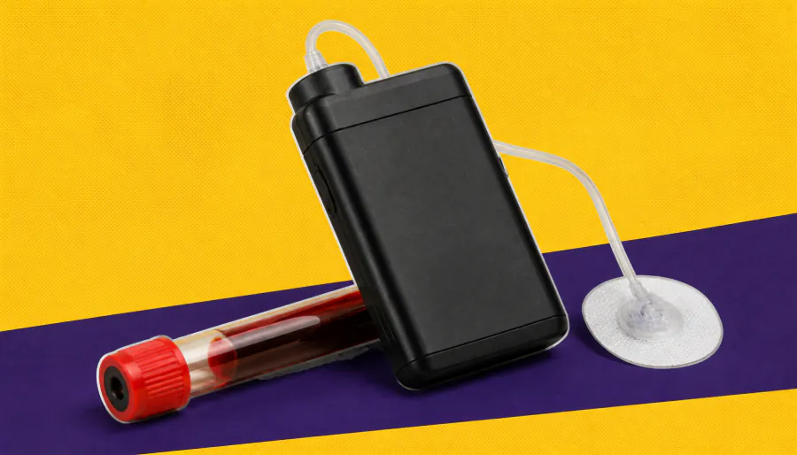 The "bionic pancreas" is transforming blood sugar control for kids with type 1 diabetes
